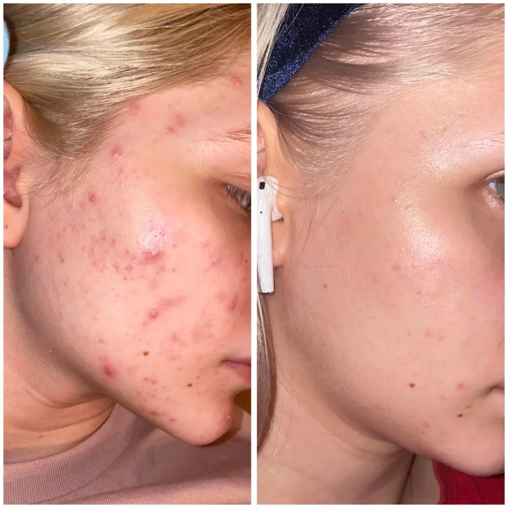 THE ORDINARY HYALURONIC ACID 2% + B5 30 ML