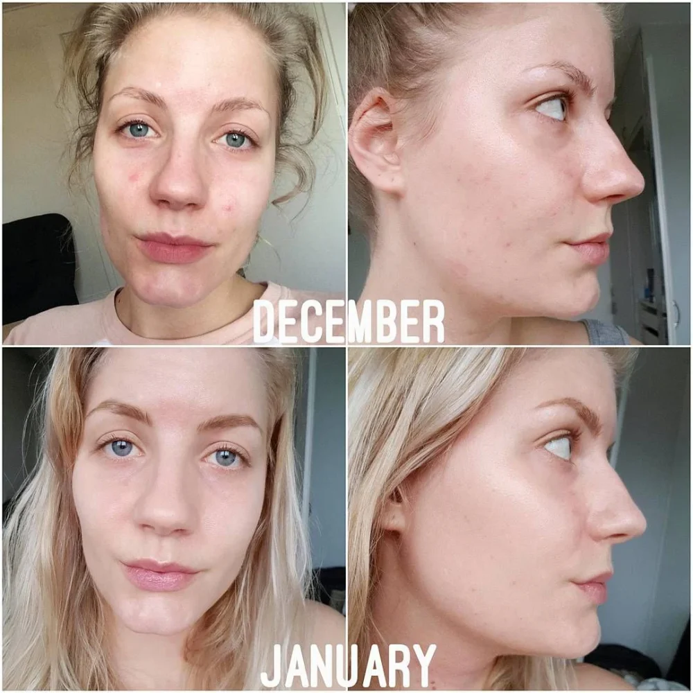 THE ORDINARY - NIACINAMIDE 10% + ZINC 1% - 30ml
