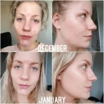 THE ORDINARY - NIACINAMIDE 10% + ZINC 1% - 30ml