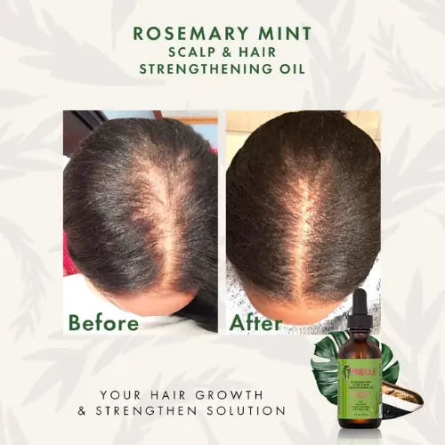 MIELLE - Rosemary Mint Scalp & Hair Strengthing Oil - 59ml MIELLE - Rosemary Mint Scalp & Hair Strengthing Oil - 59ml