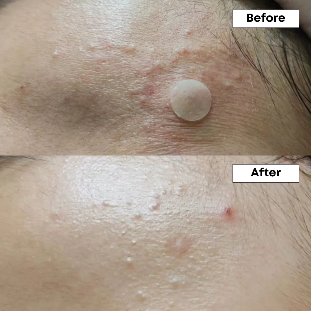 NINE LESS  A-Control 10% Azelaic Acid Serum 30ml