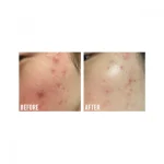 BEAUTY OF JOSEON CALMING SERUM GREEN TEA + PANTHENOL 30ML