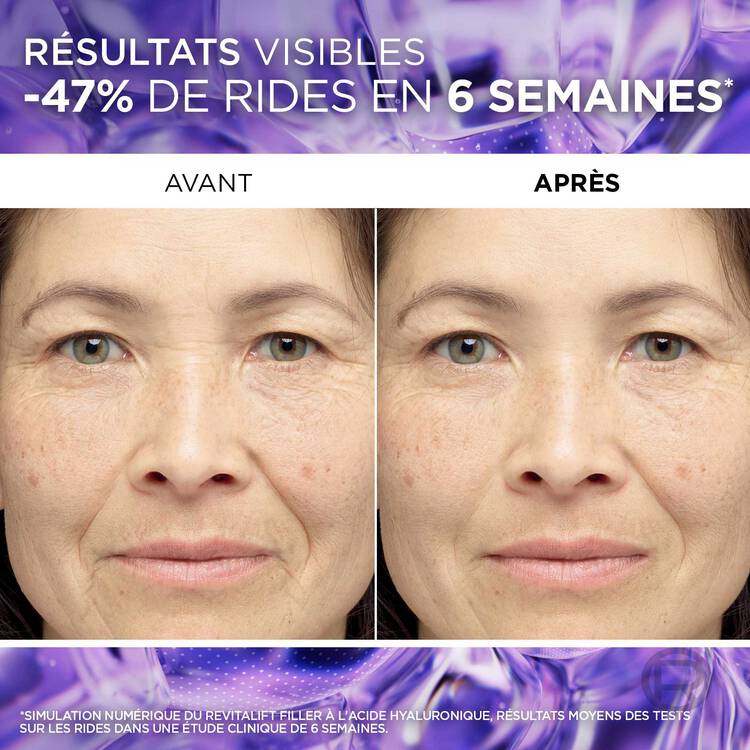 L’oréal paris Serum Anti-rides Revitalift Filler 1.5% Acide Hyaluronique Pur 30mL L’oréal paris Serum Anti-rides Revitalift Filler 1.5% Acide Hyaluronique Pur 30mL