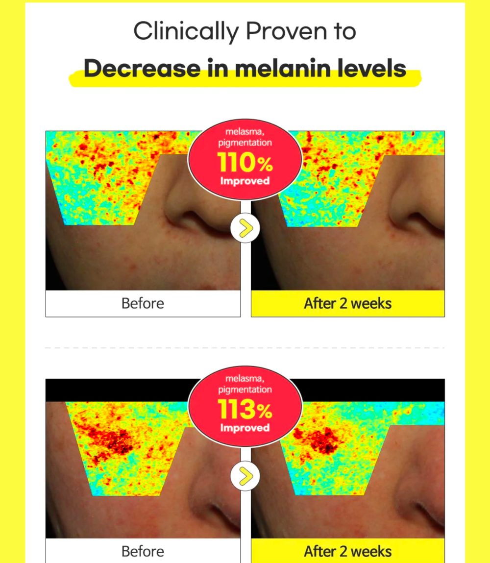 TIAM VITA B3 SOURCE BRIGHTENING SERUM 40 ML