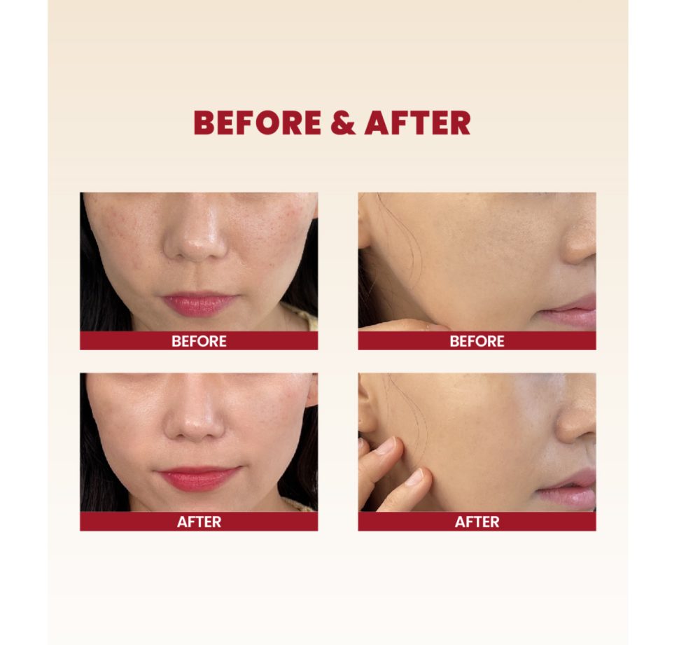 K-SECRET | SEOUL 1988 CREAM SNAIL MUCIN 93% + RICE 100ml K-SECRET | SEOUL 1988 CREAM SNAIL MUCIN 93% + RICE 100ml